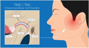 TMJ specialist Seattle WA